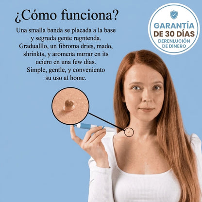 Removedor Indoloro de Fibromas